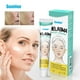 thumbnail image 3 of Melasma Care Ointment for Facial Beauty, Freckle Lightening Cream - Sumifun - 1 Piece, 3 of 5