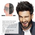 thumbnail image 3 of JAYSUING Hair Growth Roller Safe Painless Titanium Microneedle Roller Strong Root Nourish Scalp Heal, 3 of 5