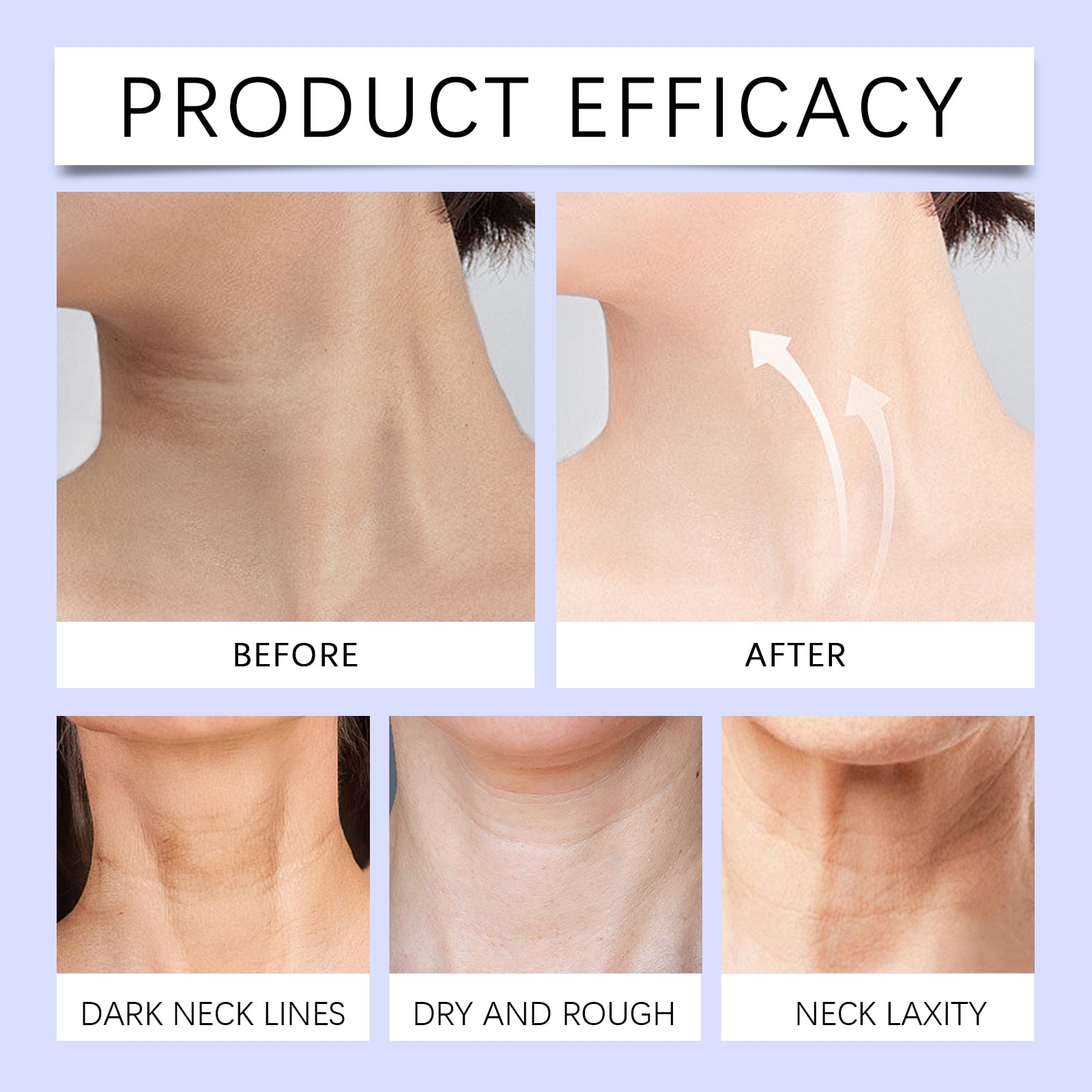 Alvantor Multi Action Neck Cream for Tightening and Firming, Moisturizing Cream 1.76oz, 3PC