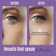 thumbnail image 5 of DERMAXGEN Eye Gel + Plant Stem Cells + Matrixyl 3000 + EYE BAG REMOVER, Arginine For Under And Around Eyes To Smooth Fine Lines, Eliminate Dark Circles, And De-puff Bags With Peptide Complex, 1 FL, 5 of 10