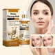 thumbnail image 5 of Azelaic Removal Cream Reduces Pigmentation And Restores Smoothness 20g, 5 of 9