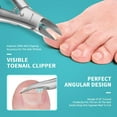 thumbnail image 3 of RONAVO Heavy Duty Toenail Clippers for Ingrown Toenails, Slanted Curved Blade Professional Toe Nail Clippers for Fine Trimming, Nail Clipper with Anti-Slip Long Handle for Men Seniors, 3 of 7
