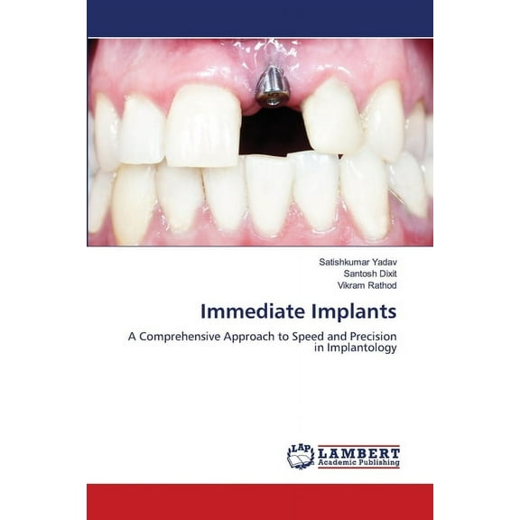 Immediate Implants, (Paperback)