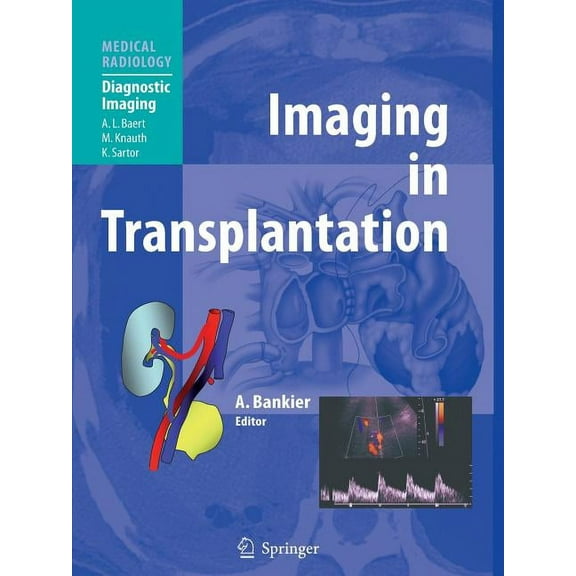 Imaging in Transplantation, (Paperback)