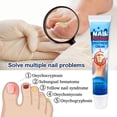 thumbnail image 2 of 20g Crema para hongos en las uñas Removedor de hongos en las uñas Crema removedora de hongos en las uñas de los pies, 2 of 5