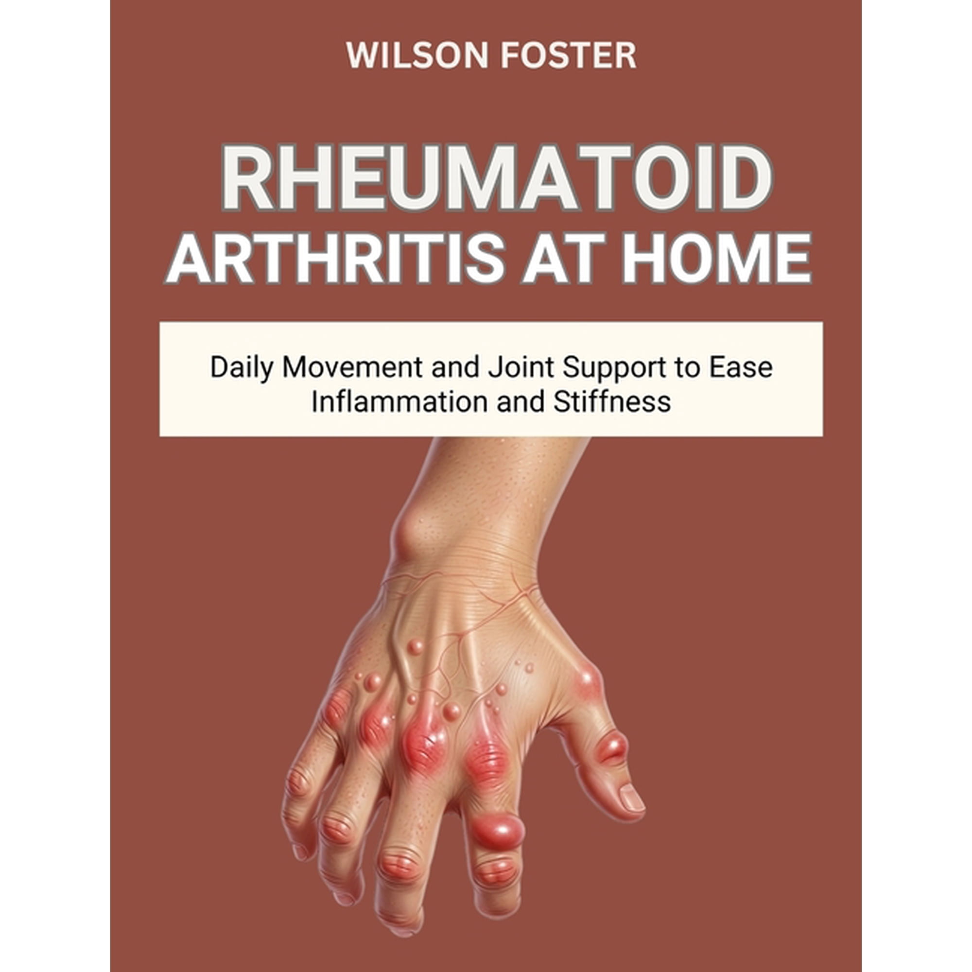 Rheumatoid Arthritis at Home: Daily Movement and Joint Support to Ease Inflammation and Stiffness, (Paperback)