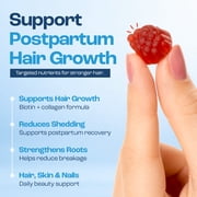 Baby Blues Postpartum Hair Loss Vitamins for Women - Hair Growth Gummies with Biotin 6000mcg, Collagen, Zinc & Folate, Hair Skin and Nails Supplement, Passion Fruit Flavor, 60 Count