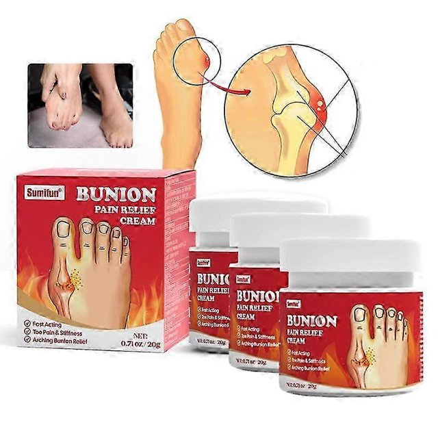 piezas 2024 nuevo ungüento para aliviar el dolor de juanete arqueado del pie crema correctora de valgo del dedo del pie hallux