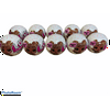 10 Pack - L.O.L. Surprise! Dolls Glitter Series Limited Edition