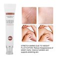 thumbnail image 2 of Líneas contra el embarazo, Crema Antiestrías, Crema Corporal para Diluir las Estrías, Crema hidratante para pieles secas y sensibles, Kit de cuidado de la piel para estrías y e Protección de La Piel Octpeak NO, 2 of 7