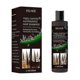 thumbnail image 1 of 1-3 uds Champú antipicazón Yuxing 100 ml Champú refrescante con aceite anticaída, 1 of 5