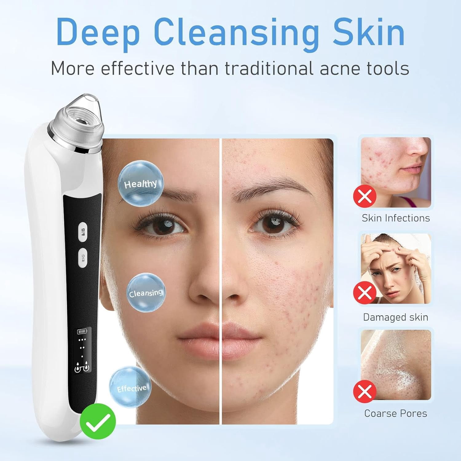 2025  HD Camera Blackhead Vacuum - USB Rechargeable Pore Cleaner with 6 Heads & 3 Power Levels for Deep Cleansing(Orange)