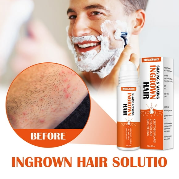 20ml Razor Bumps Treatment Reduce Redness Compact Plant Extracts Shaving Waxing Ingrown Hair Liquid for Men
