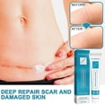 thumbnail image 3 of 2pcs 20g Scar Removing Cream Multipurpose Smoothing Smooth Skin Repairing Cream, 3 of 3