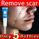 thumbnail image 2 of La eliminación de cicatrices y belleza de las mujeres mantiene la cara hidratada y repara la piel dañada, reparación postoperatoria de cicatrices, 2 of 5