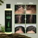 thumbnail image 3 of Champú Tgideas Organic Rosemary para crecimiento del cabello, 220 ml, para mujeres y hombres, 3 of 9