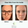 thumbnail image 5 of Innate Skin Acne System, 60 Piece, 2 Pack, 5 of 12