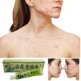 thumbnail image 1 of Crema facial a base de hierbas naturales, crema corporal, crema Medicinal china, crema antipicazón para uso externo, 1 of 5