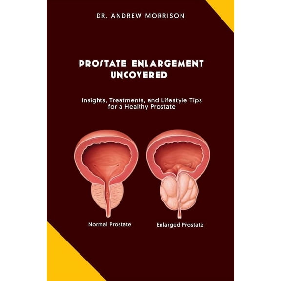 Prostrate Enlargement Uncovered: Insights, Treatments, and Lifestyle Tips for a Healthy Prostate, (Paperback)