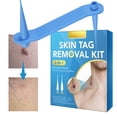 thumbnail image 3 of Kit de bandas de eliminación de etiquetas de piel para hombre Wdftyju y mujer accesorios para el cuidado del cuerpo eliminador de verrugas y lunares, 3 of 9