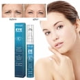 thumbnail image 1 of Crema para ojos para líneas finas y ojeras | Fórmula Hidratante, Lifting, Antioxidante | Reduce las arrugas, reafirma, ilumina debajo de los ojos | Reparación suave para pieles sensibles | 15 ml, 1 of 7