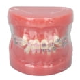 thumbnail image 2 of Modelo Dental de Ortodoncia NikouMX Resina, 2 of 8