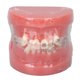 thumbnail image 2 of Modelo Dental de Ortodoncia NikouMX Resina, 2 of 8
