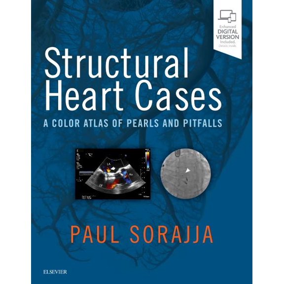 Structural Heart Cases: A Color Atlas of Pearls and Pitfalls, (Hardcover)