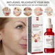 thumbnail image 3 of Suero facial antienvejecimiento con Retinol, hidratante, eliminador de arrugas, colágeno, ácido hialurónico, esencia, cuidado de la piel, cosmético coreano, 3 of 4