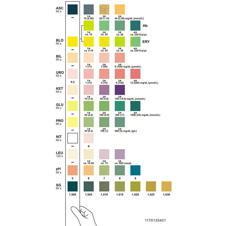 Urinalysis Test Strip Color Chart