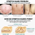 thumbnail image 2 of Postpartum Repair Cream Fade Growth Lines Repair Cream 30g, 2 of 4