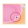 thumbnail image 4 of 1 Uds. (blanco perla, aproximadamente 88*32mm) caja de tirantes invisibles caja de dentaduras postizas de ortodoncia caja de almacenamiento portátil, caja para alineadores y retenedores, 4 of 4