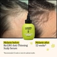 thumbnail image 3 of California Naturals Re:GRO Anti-Thinning Scalp Serum, 3 fl oz, 3 of 6