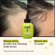 California Naturals Re:GRO Anti-Thinning Scalp Serum, 3 fl oz