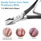 thumbnail image 4 of Cuticle Trimmer Professional - Cortador de cutículas de acero inoxidable Cortador de cutículas profesional Cortacutículas Tijeras Removedor de cutículas Herramientas de manicura por Adepaton CDWJ108, 4 of 5