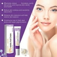thumbnail image 4 of Azelaic 12 Percent Cream For Relief Dark Spots Facial Serum With Vitamin C Azelaic Serum For Excess Sebum Soothe Irritation 20g, 4 of 8
