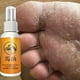 thumbnail image 3 of Spray Para Pies A Base De Hierbas Anti Hongos Alivia La Crema Beriberi Cuidado De La Piel Tratamiento Del Dedo Pie Infección Micótica Reparación De, 3 of 3