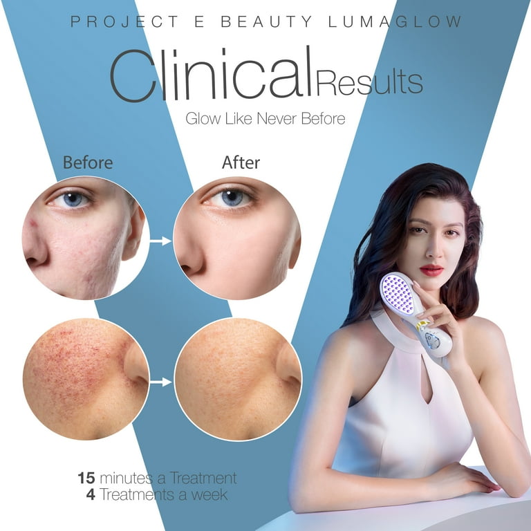 Project E Beauty LumaGlow Blue | Anti-Acne LED Light Therapy Wand