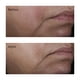 thumbnail image 4 of Tónico Perricone MD, sin enjuague, para minimizar los poros, 120 ml, 4 of 5