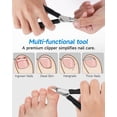 thumbnail image 4 of Nail Clippers,Toenail Clipper for Ingrown or Thick Toe Nails,Fingernail Clipper for Men Women Seniors with Stainless Steel Straight Blade Soft Handle Nail Cutter Black, 4 of 5