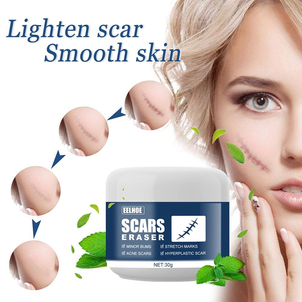 Scar Removal Cream Acne Scar Remover Cream Smooth Scar Lightening Cream