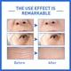 thumbnail image 5 of Xihbxyly Suero Antiarrugas, Elixir Reafirmante, Tratamiento Reductor de Líneas de Expresión, Hidratante No Graso, Rutina Diaria de Cuidado de La Piel, Solución Antiedad, Fabricado En Ee. Uu., 5 of 7