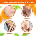 thumbnail image 4 of Crema Despigmentante Neoprosone Beige para Manchas Oscuras Corporal y Facial, 4 of 9