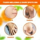 thumbnail image 4 of Crema Despigmentante Neoprosone Beige para Manchas Oscuras Corporal y Facial, 4 of 9