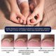 thumbnail image 3 of Professional Foot Anti-fungal Treatment Solution To Remove Onychomycosis Care Repair Liquid Healthy Nail Care Repair Liquid, 3 of 4