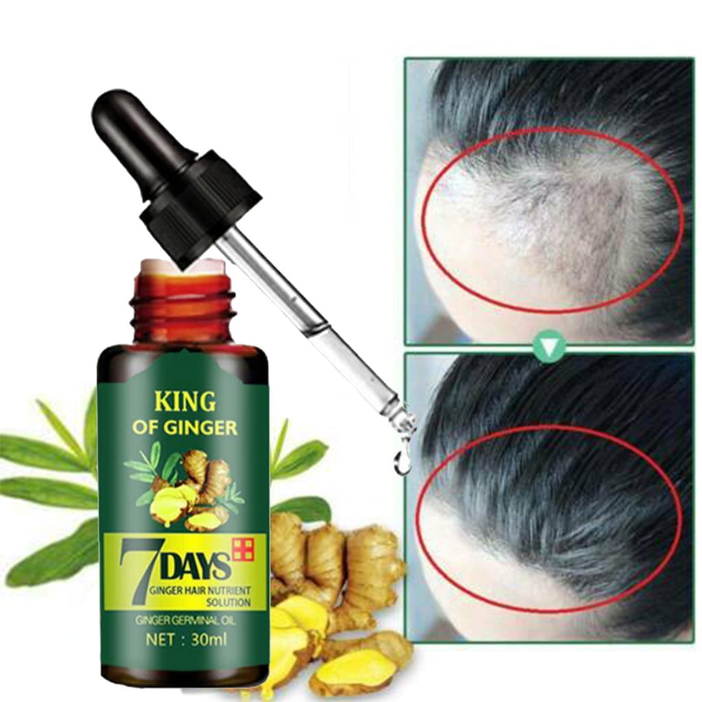 Natural Ginger Hair Care Essence Nutrient Solution Deoiling Treatment Of  30ML 
