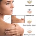 thumbnail image 4 of Silicone Scar Patches Scar Patches Silicone Scar Patches Reusable And Effective Scar Removal Plate Scar Tap Roller For Softening And Flattening Scar S, 4 of 4