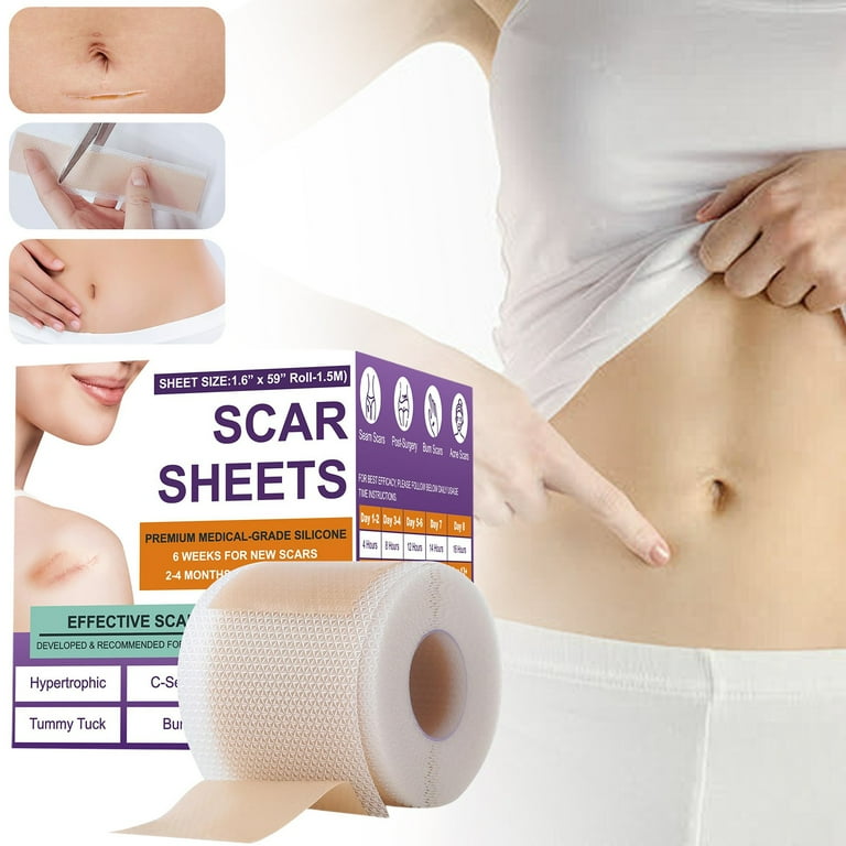 Silicone Scar Sheets – Silicone Scar Tape for C-Section, Tummy Tuck & Keloid Scars (1.6" x 59" Roll, 1.5M) – Effective Scar Removal & Keloid Bump Treatment