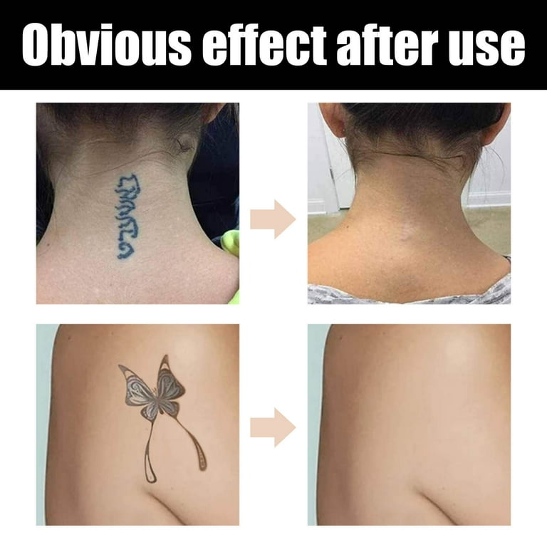 EARKITY Tattoo Cover Up, Tattoo Cover Up Makeup Waterproof, Professional Tattoo Concealer for Dark Spots, Scars, Vitiligo, And More
