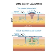 Scarguard MD 0.5 fl oz